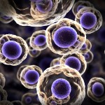 cancer cells